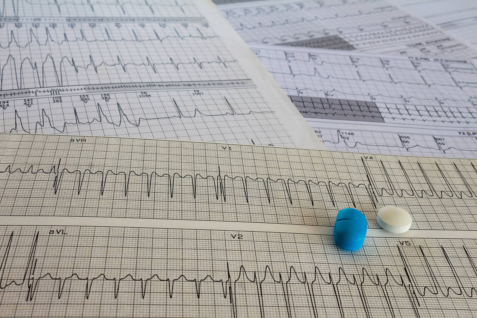 Among the most common diseases in old age is heart failure