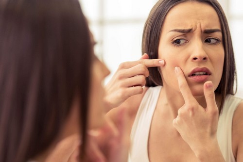 Che cos'è l'acne lieve e come si cura?