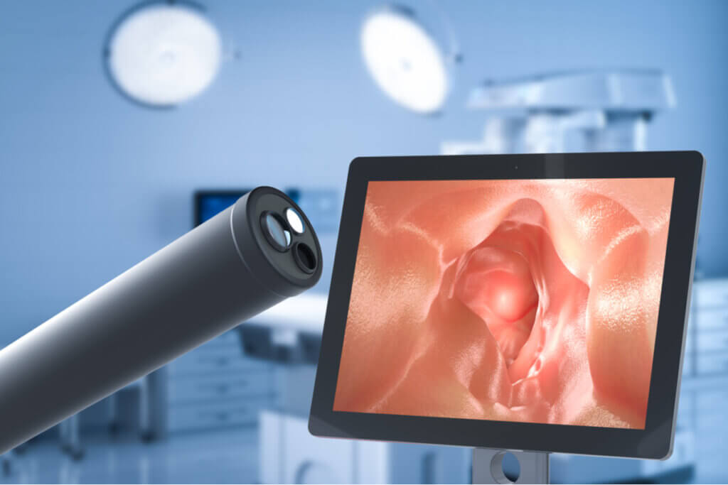 Endoscopia cuando se diagnostica celiaquía.
