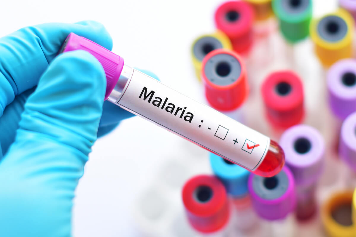 ¿Qué es la malaria?