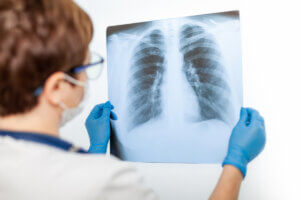 Diagnóstico de la neumonía