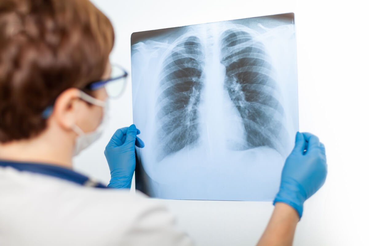 Diagnóstico de la neumonía