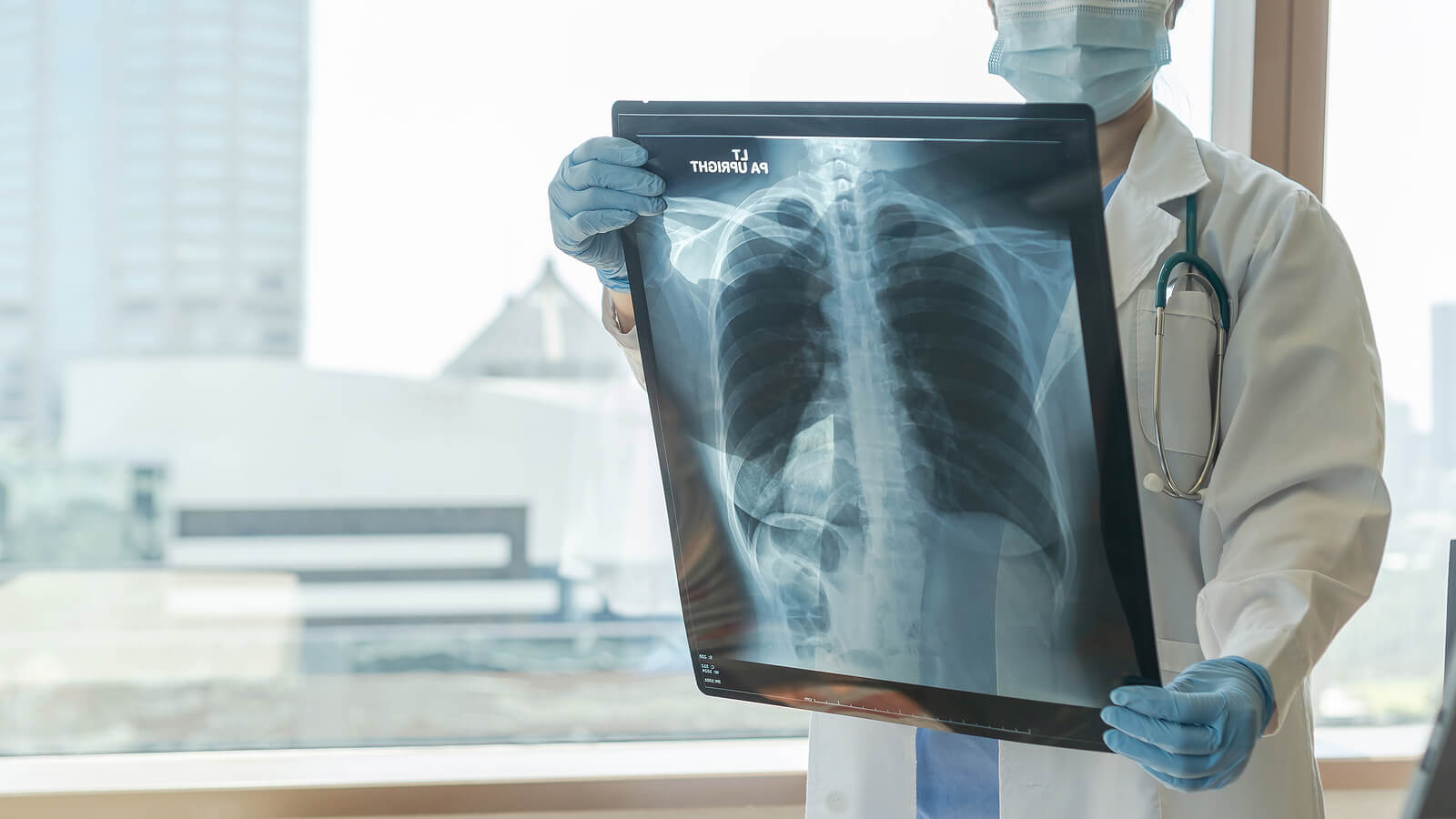 Clasificación de la OMS de la hipertensión pulmonar