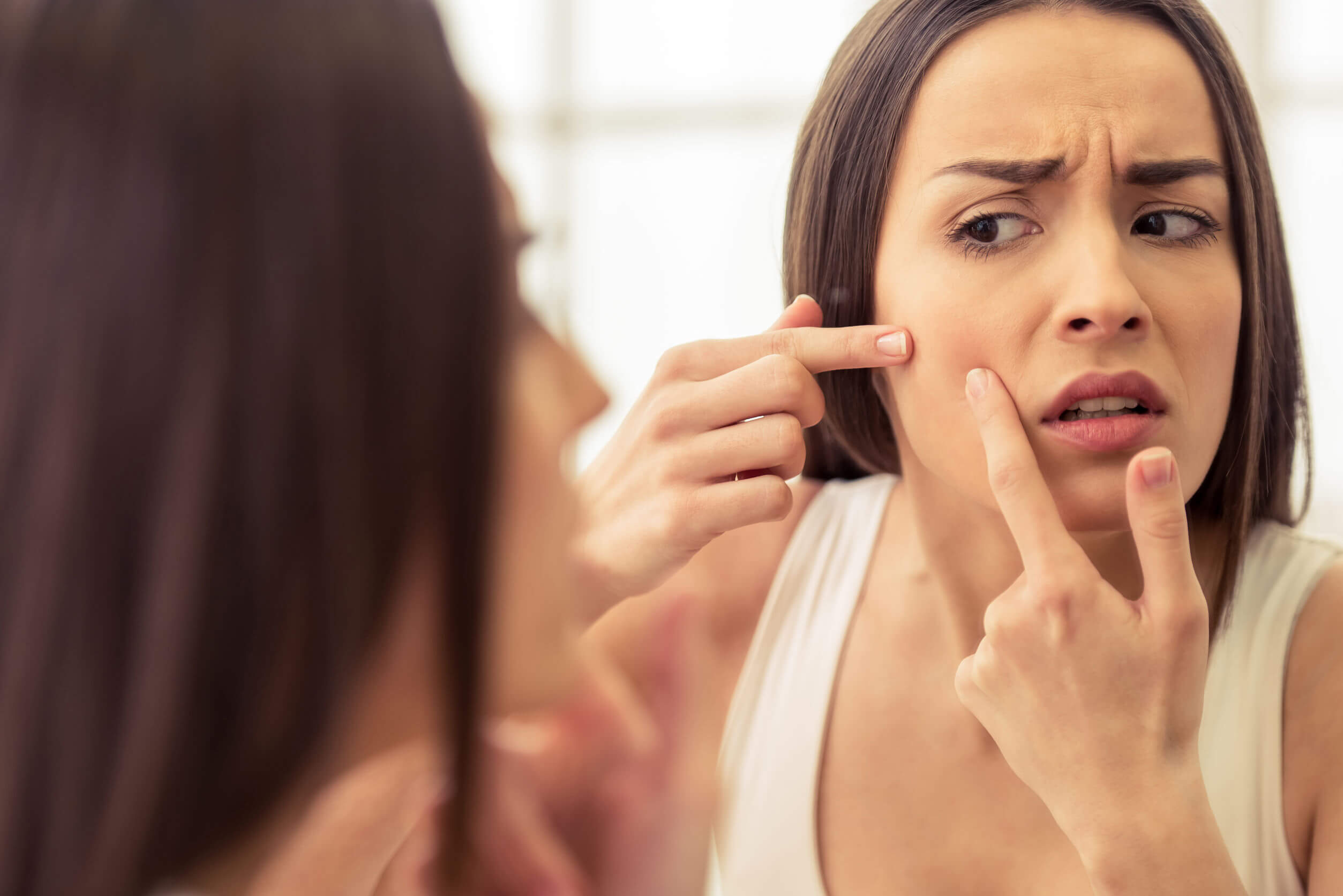 Symptoms of PCOS include acne breakouts