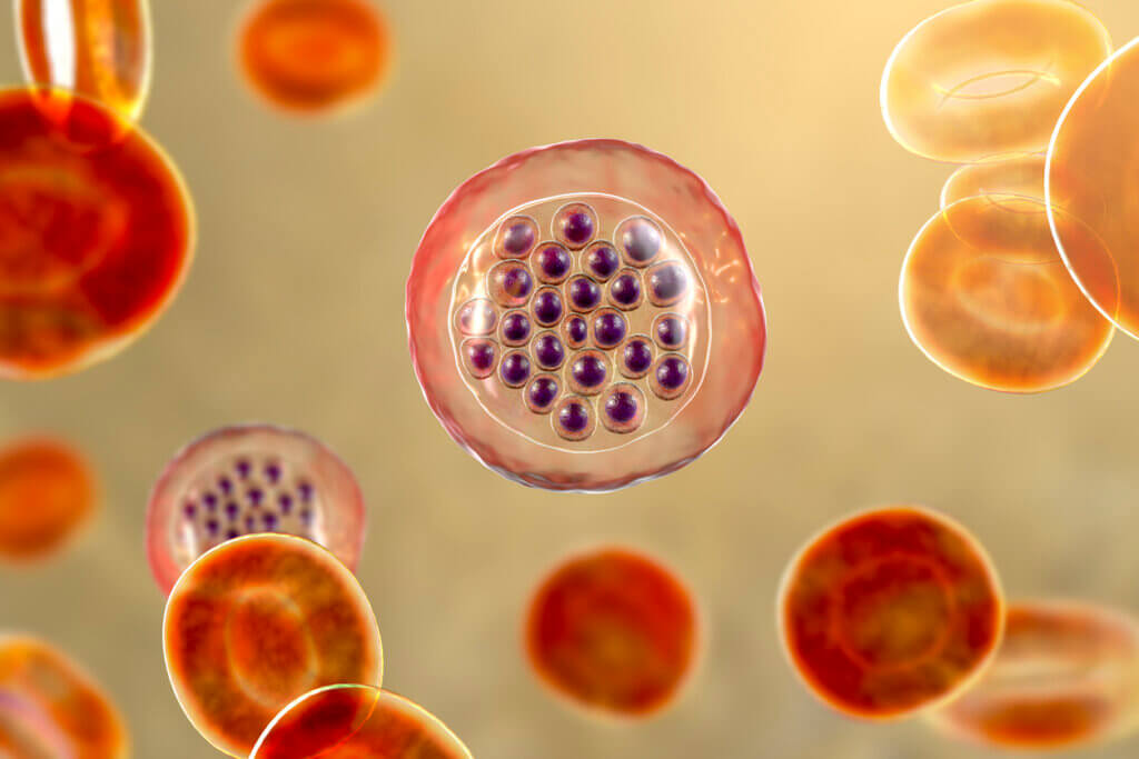 Malaria en los glóbulos rojos.