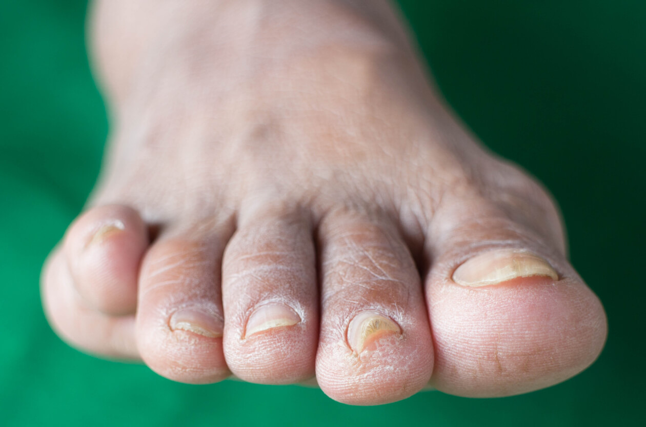 Efectos secundarios y comorbilidades de la diabetes