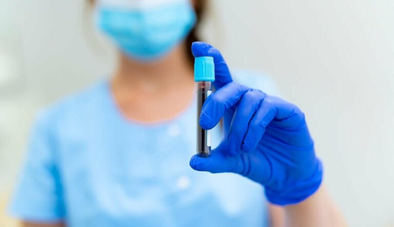 Che cos'è la celiachia latente?