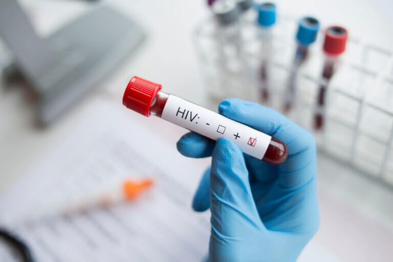 Causas y factores de riesgo del VIH