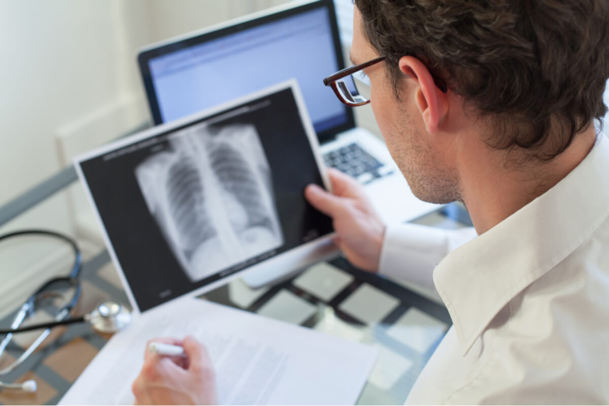 Lung cancer diagnosis includes x-rays