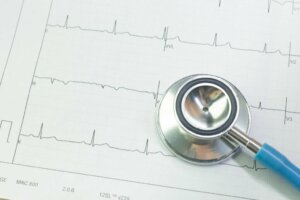 What Is Bradycardia?