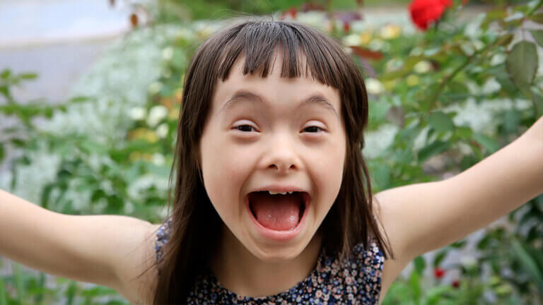 Down Syndrome Symptoms