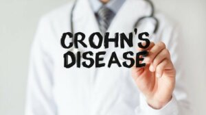 What Is Crohn's Disease