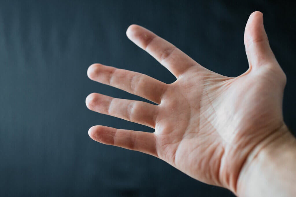 O que é esclerodermia?