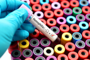 What Is Hemophilia?