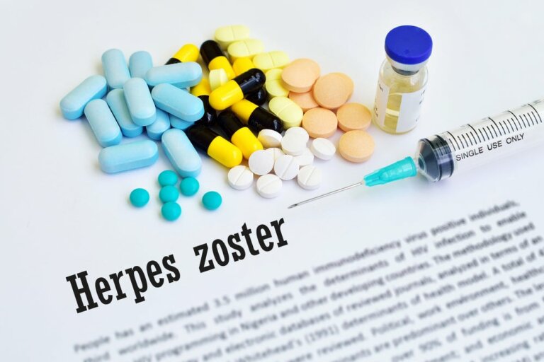 Herpes Zoster or Shingles: An Old "Friend"