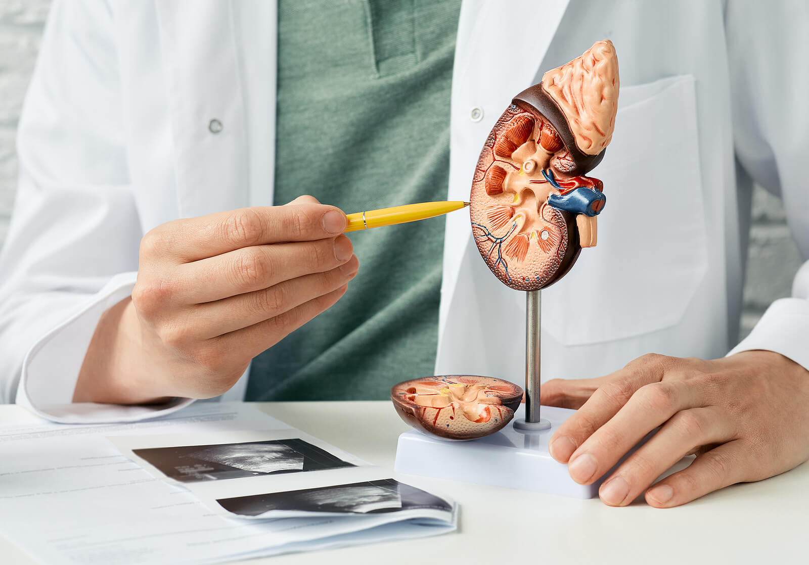 A doctor pointing to a model of a kidney.