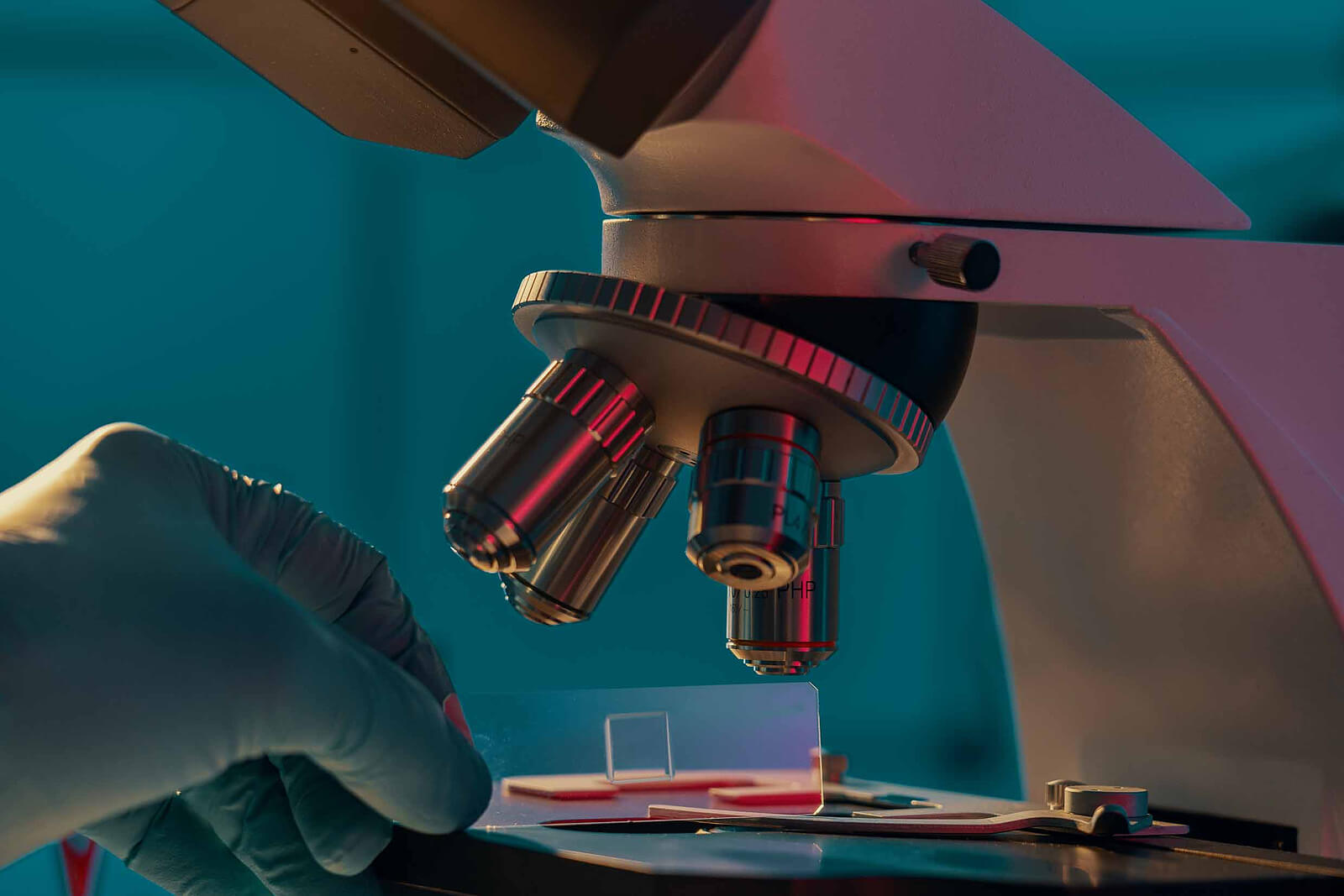 Los tipos de cáncer de colon según su anatomía patológica