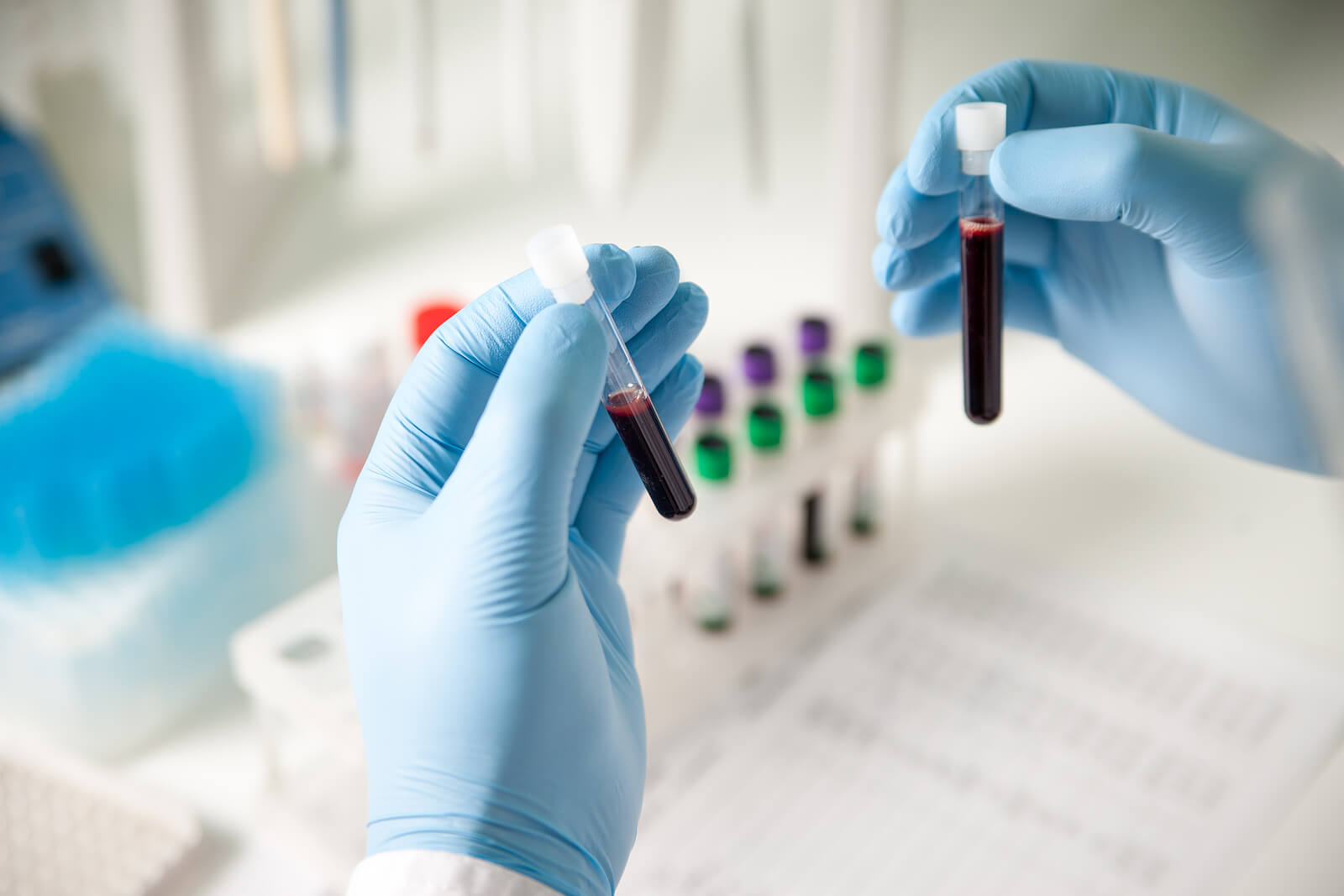 Neutropenia is diagnosed with a laboratory test.