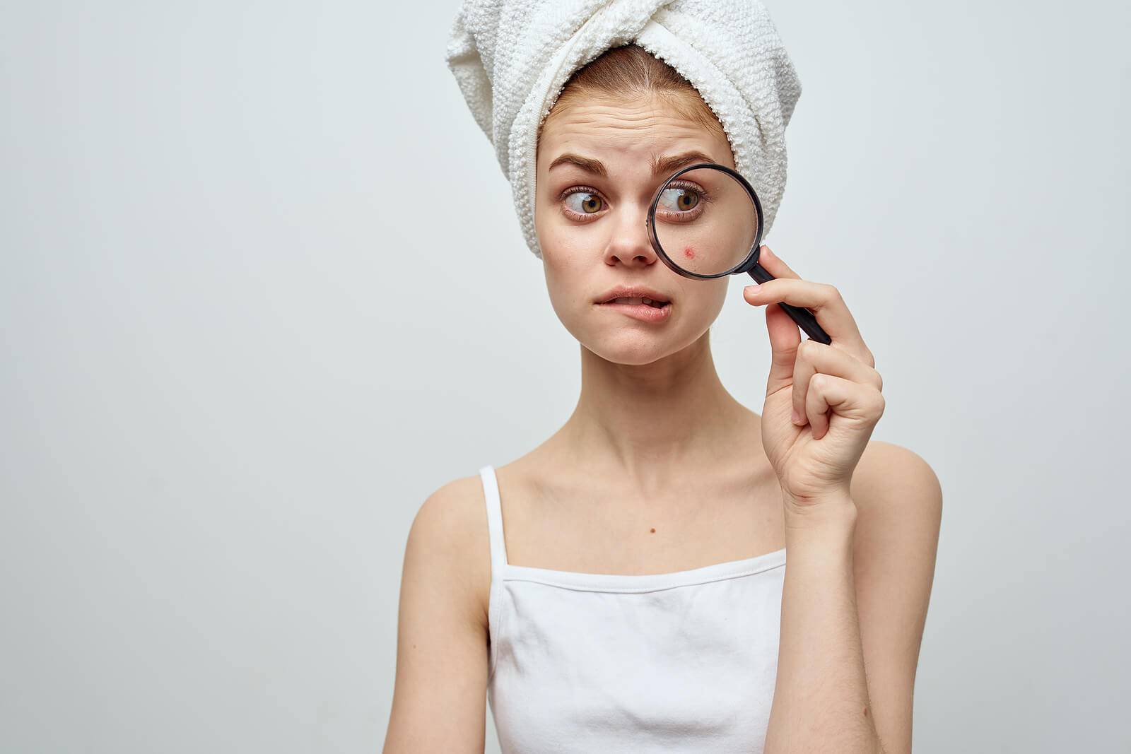 Signos y síntomas del acné