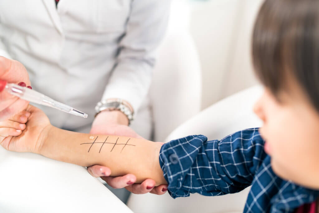 Allergy test in a child.