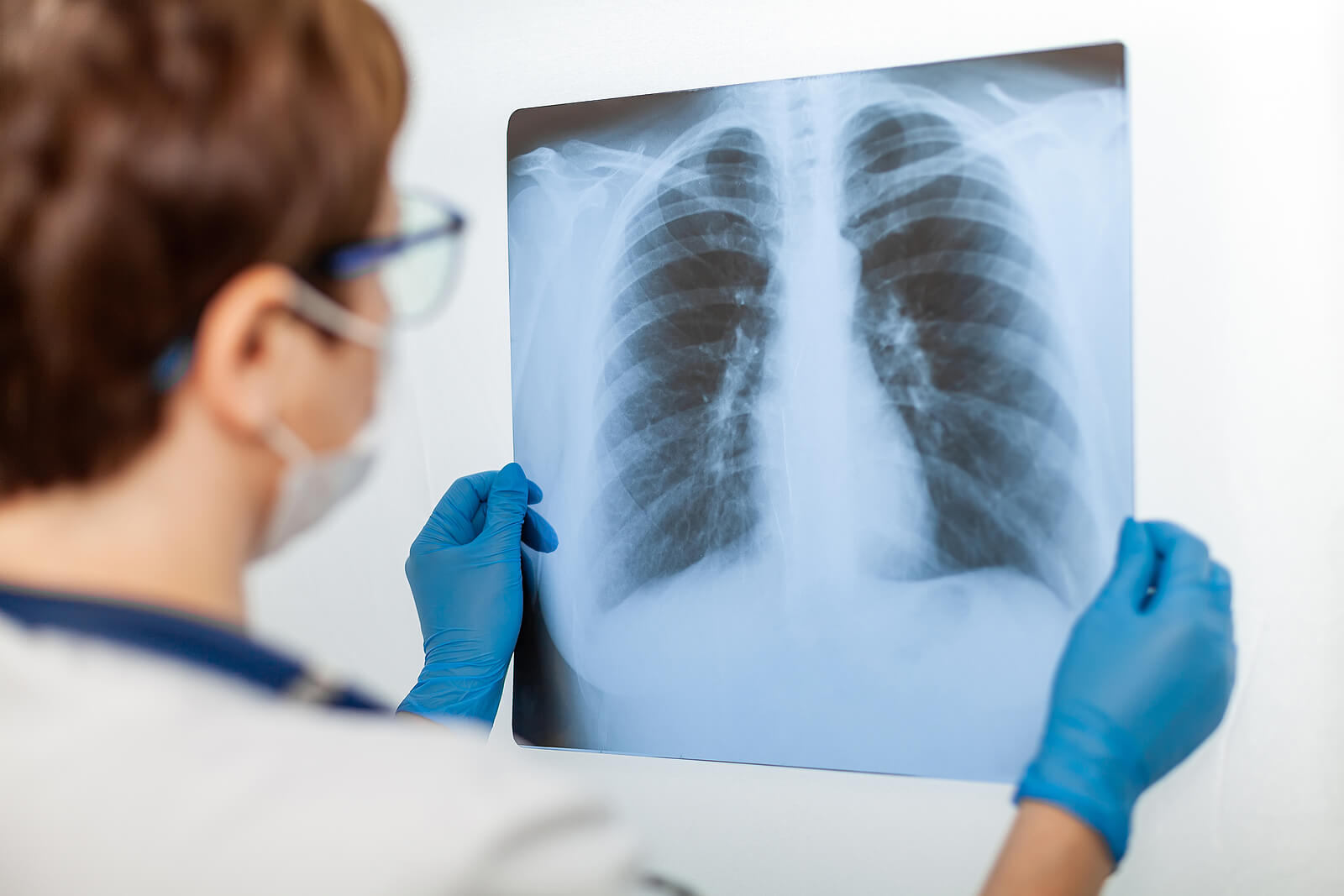 Radiographie des poumons. 