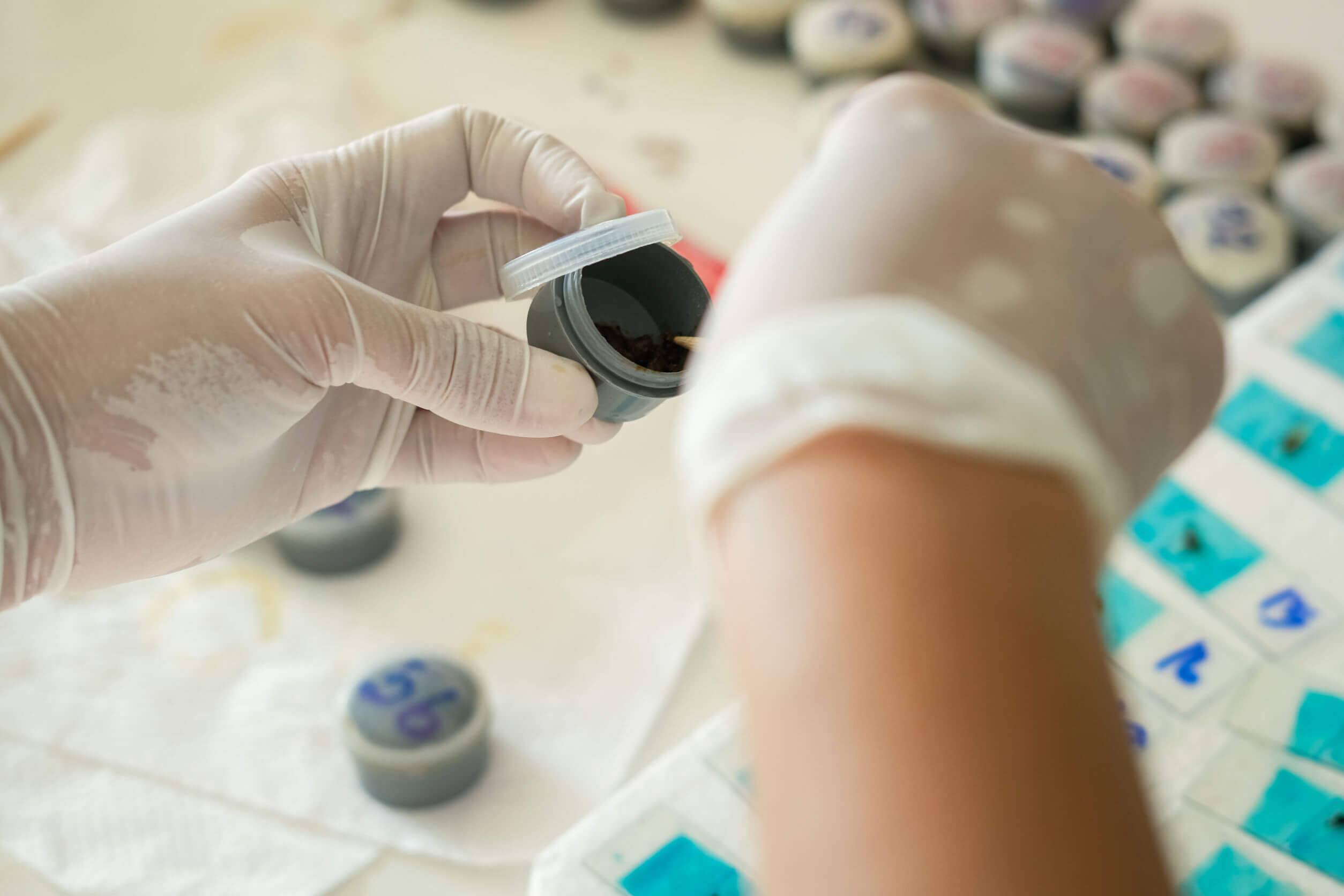 El diagnóstico de la colitis ulcerosa incluye examen de heces
