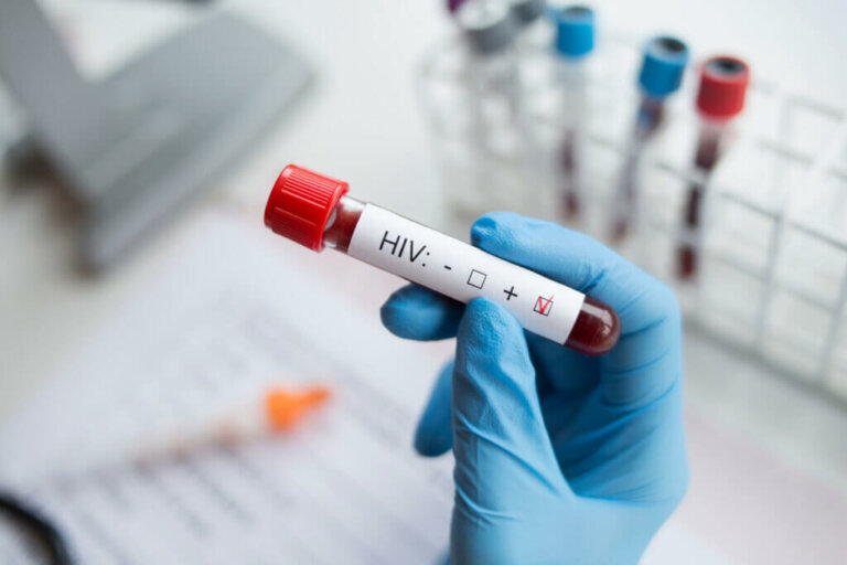 Causas e fatores de risco do HIV