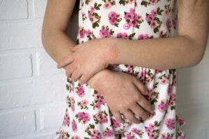 Causas da dermatite de contato