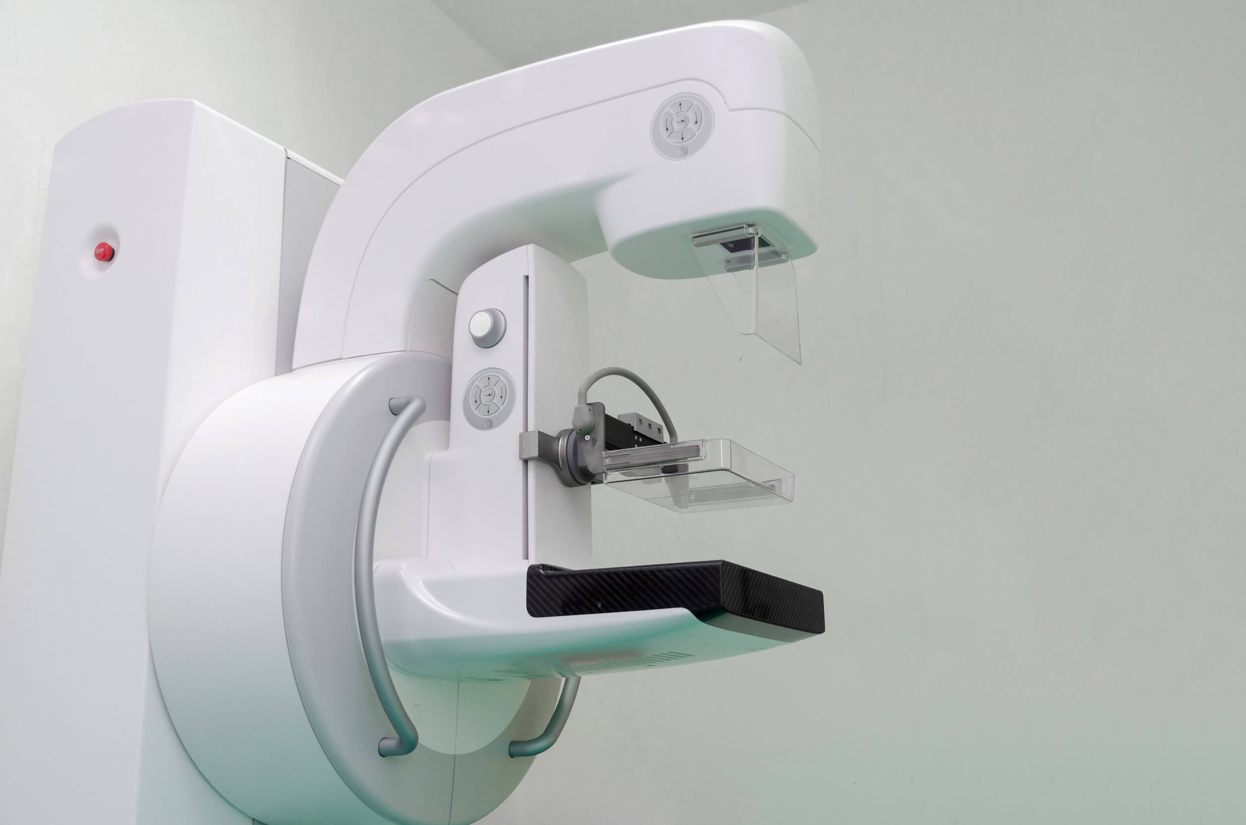 Mamografía 3D: todo lo que debes saber