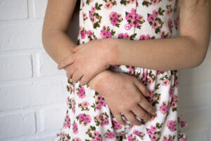 Causas de la dermatitis de contacto