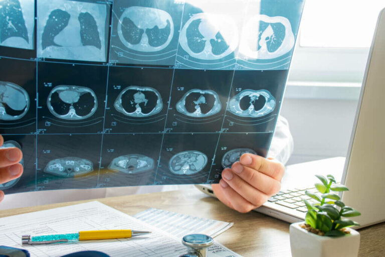 Quels sont les examens de diagnostic du cancer du poumon?