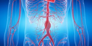 The 3 Types of Aneurysms