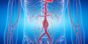 Los 3 tipos de aneurismas