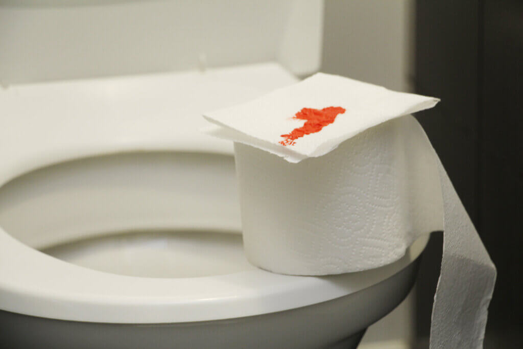 Causes Of Blood In Stools   Bleeding Toilet Paper 1024x683 1 