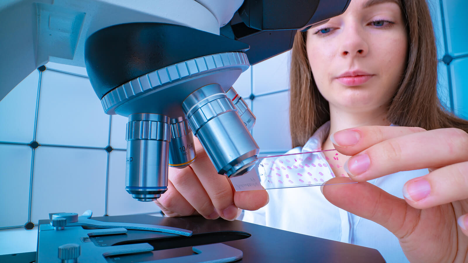 Diagnóstico del cáncer de colon