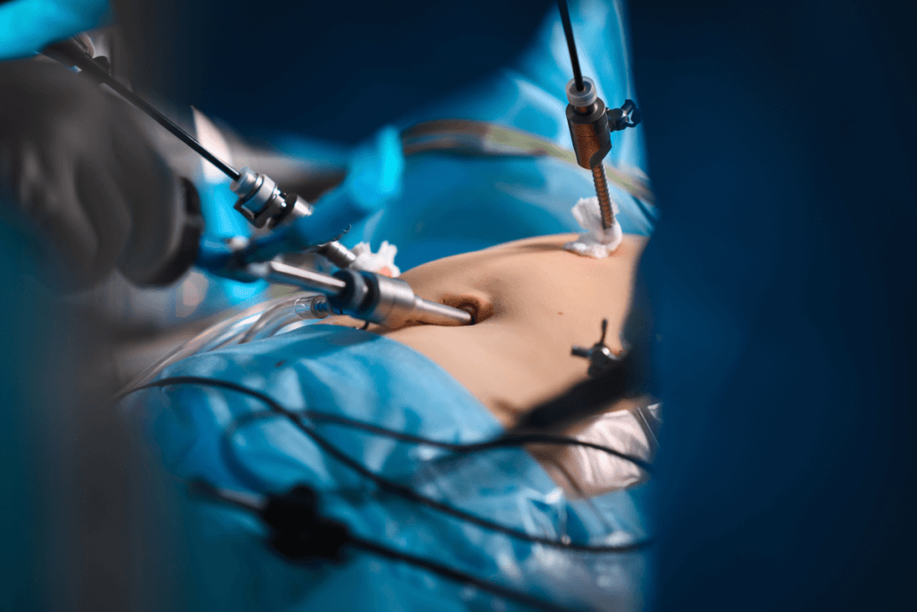 Qu'est-ce que l'hystérectomie? Risques et considérations