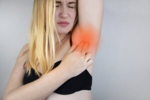 What is Hidradenitis Suppurativa?