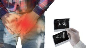 As 8 doenças mais comuns em homens