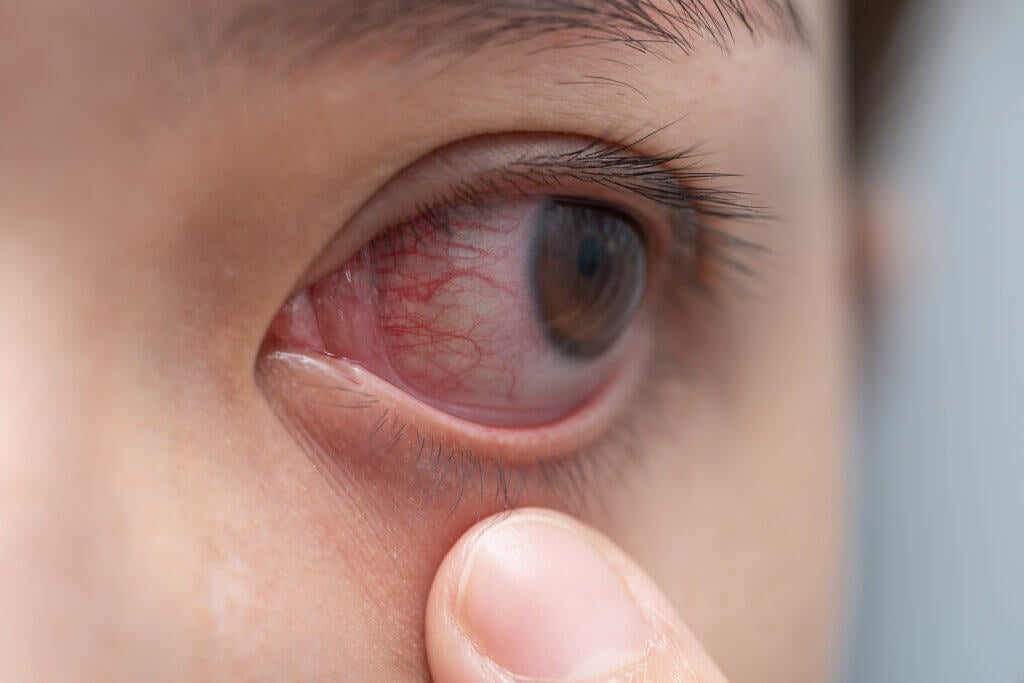 Le 10 malattie degli occhi più comuni