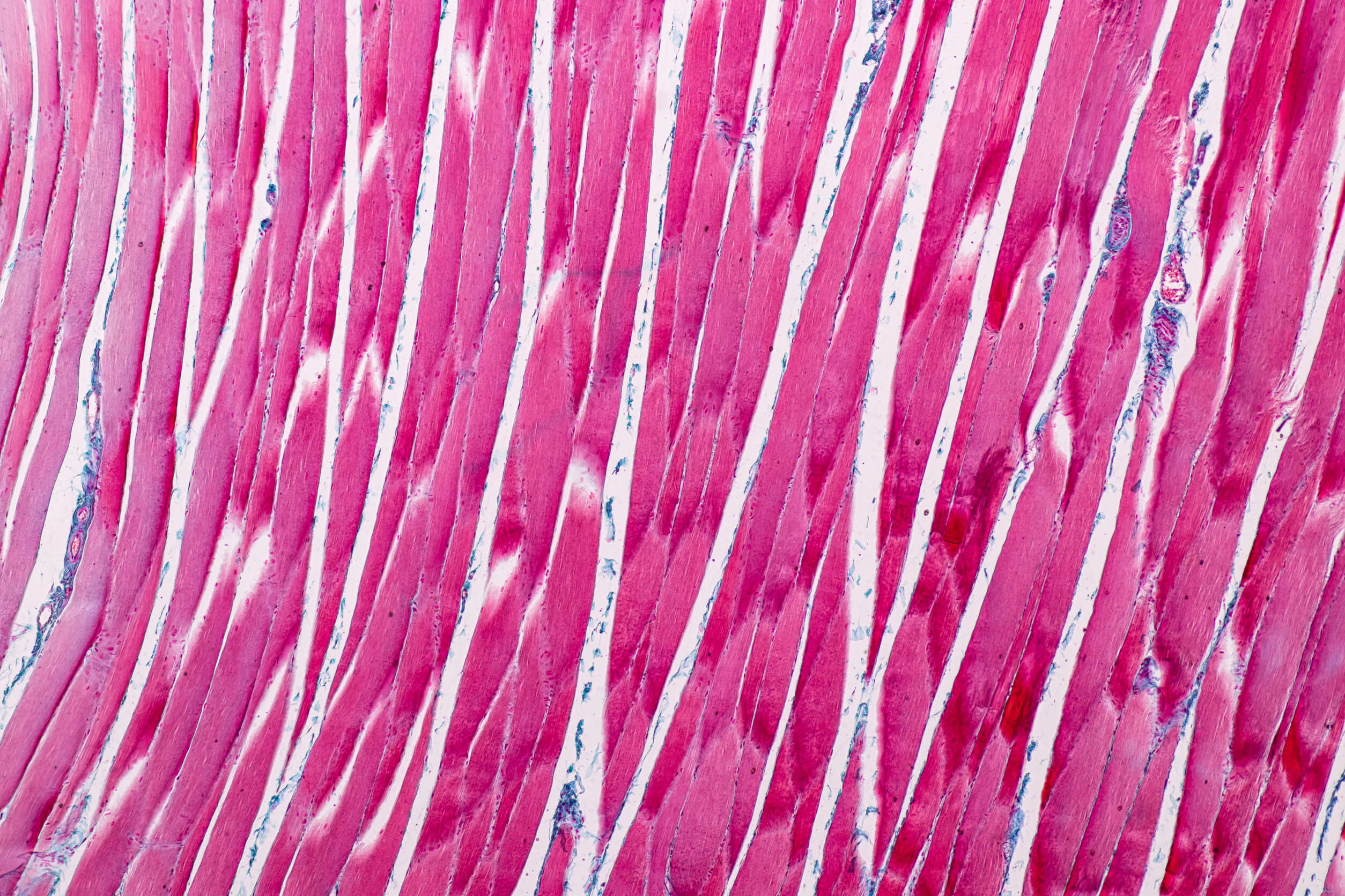 The rarest diseases in the world include musculoskeletal problems