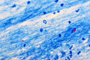 What Is Smear Microscopy?