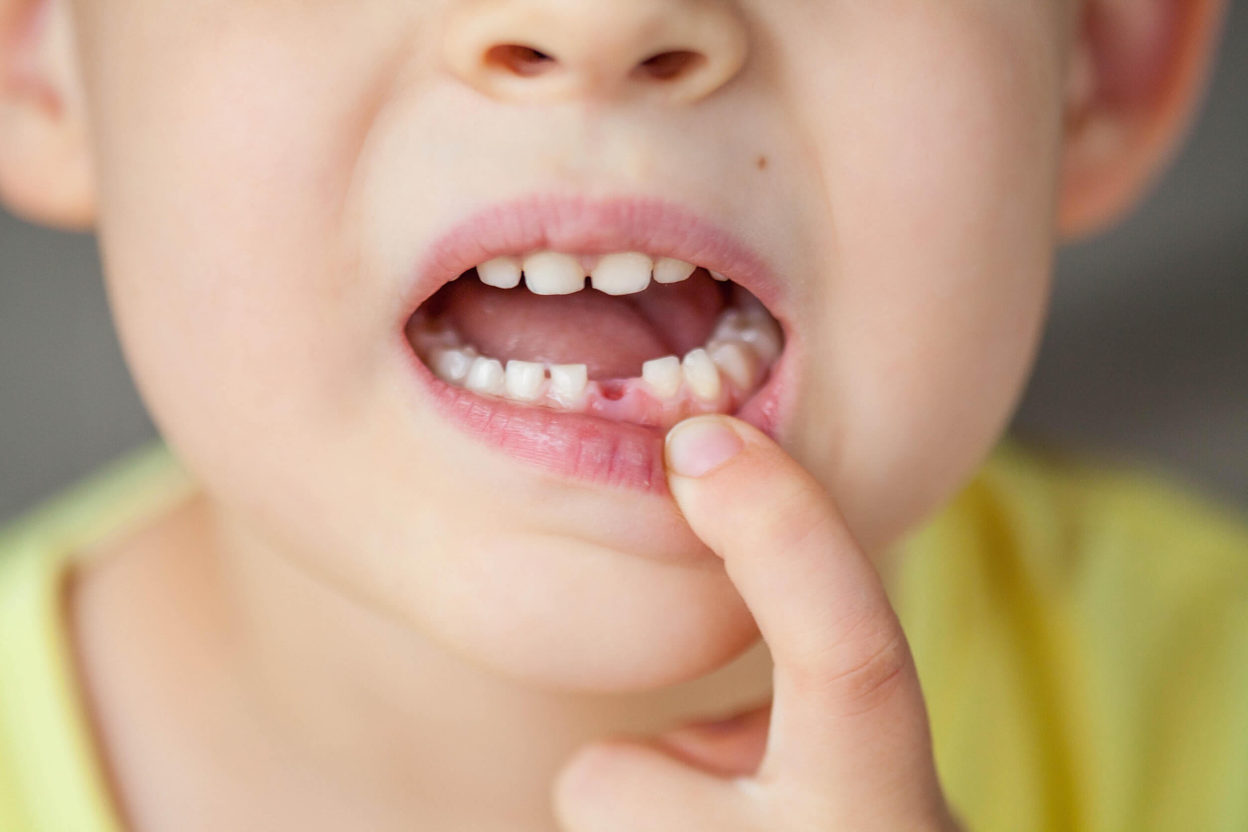 Los tipos de dientes incluyen a los dientes de leche