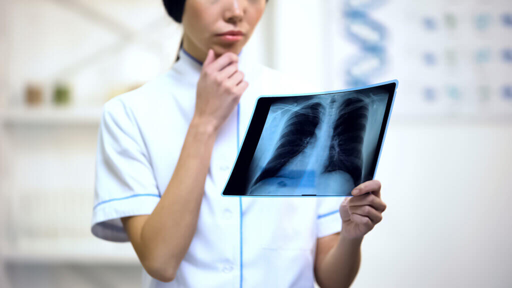 A doctor looking at a chest x-ray.
