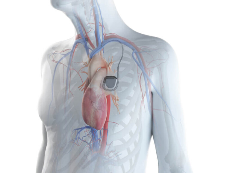 Stimulateur cardiaque : quelle est sa fonction?