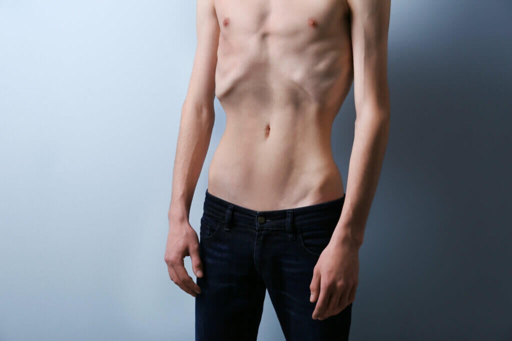 Diferenças entre anorexia e bulimia