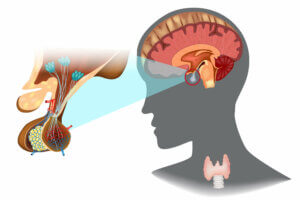 ¿Qué es la acromegalia?