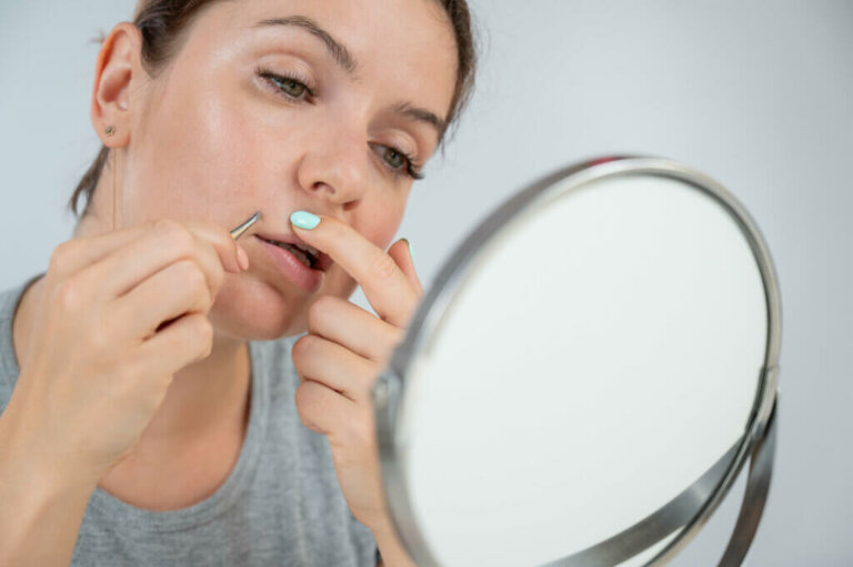 What Is Hirsutism and How to Treat It?