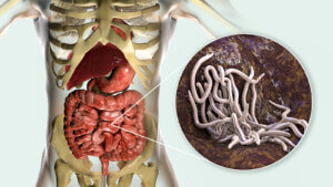 Los 9 tipos de parásitos y sus características