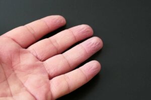 Perché la pelle si raggrinzisce nell'acqua?