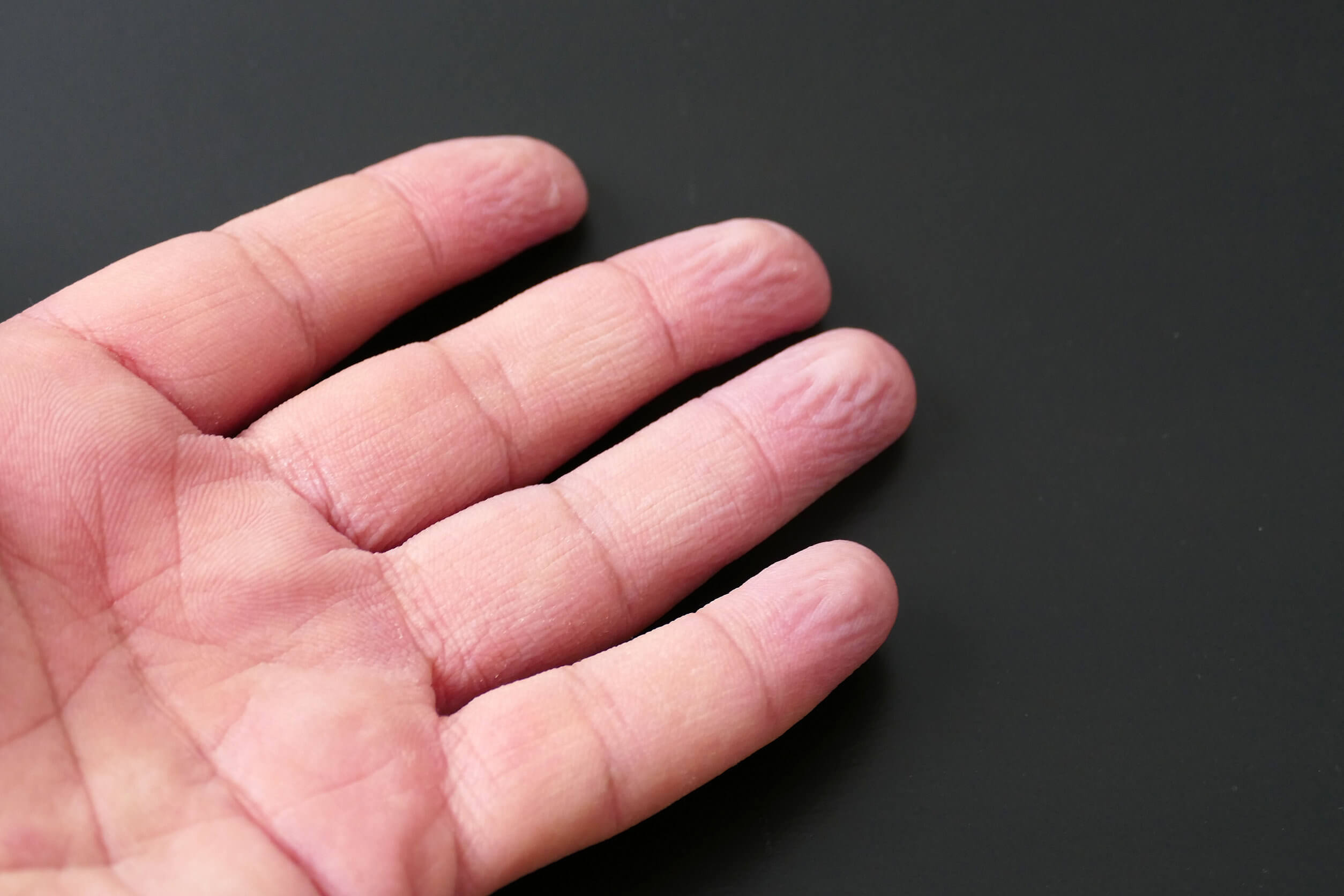 ¿Por qué se arruga la piel en el agua?